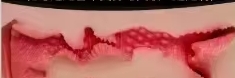 Vagina type 3